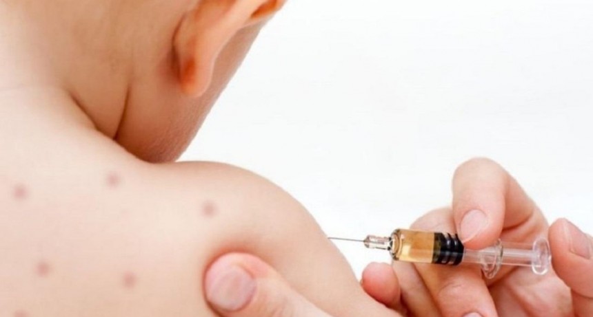 NUEVAS RECOMENDACIONES DE VACUNACI&Oacute;N PARA CONTROLAR EL BROTE DE SARAMPI&Oacute;N EN CURSO