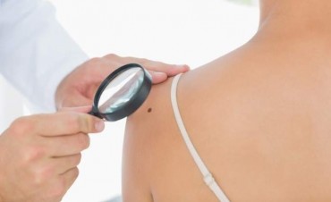 Campana adhiere a la campa&ntilde;a nacional de prevenci&oacute;n del c&aacute;ncer de piel 