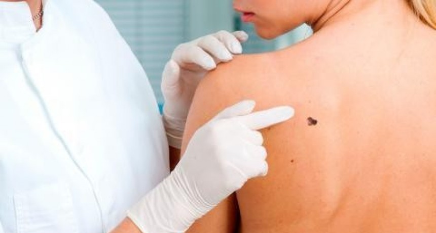 Continúan los controles gratuitos para la prevención del Cáncer de Piel 
